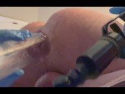 Pumping And Fucking Giant Anal Gape 👻  Swollen asshole pumped and fucked!! Big Dildo.