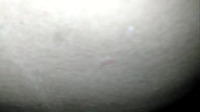 Depois do carnaval cunhada Ana PL acordou levando picada e s&oacute_ tinha 18 aninhos