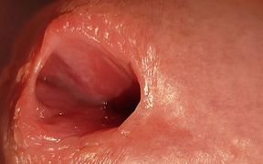 How to Widen a Glans Hole to the Extreme.