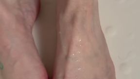 Veins after a hot shower