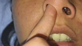 Nose, Mucus and More