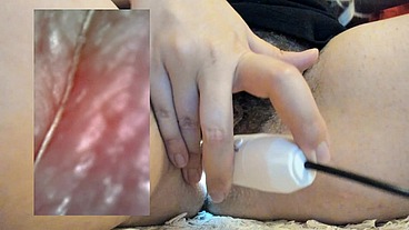 Extreme vore compilation - Extreme vaginal endoscopy orgasm