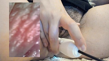 Extreme vore compilation - Extreme vaginal endoscopy orgasm