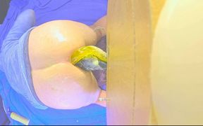 Analgasm 2 Dildos Stretching My Ass Apart Loud Farting