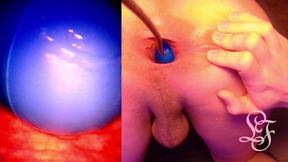 Split Screen Look Inside Lina's Gaping Ass with Eggs