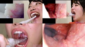 Miki Sunohara - Observing Sunohara Miki's teeth, mouth, and back of the throat with a dental camera - 1080p