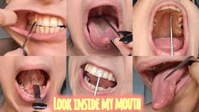 In-depth analysis of my mouth!