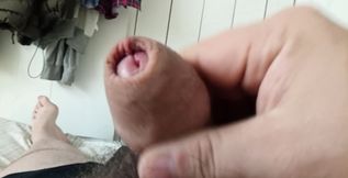 Smegma Cock Swollen Foreskin