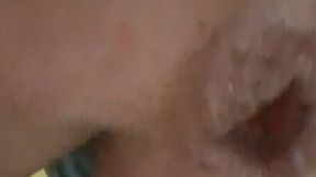 i jerk off my hemorrhoids and bring them to prolapse
