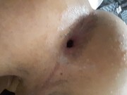 I dildo me I have dilated hole
