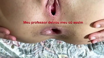 Pessoal &eacute_ muito dolorido aprender tocar viol&atilde_o