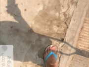 AMPUTEE guy walking with crutches