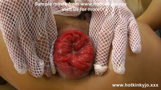 Sexy maid Hotkinkyjo elbow anal fisting, belly bulge &amp; prolapse with Dirtygardengirl