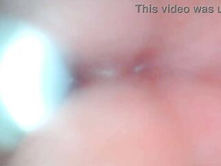 Endoscope camera captures moment of male ejaculation