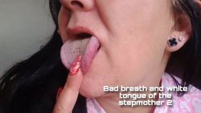 Bad breath and white tongue of the stepmother 2