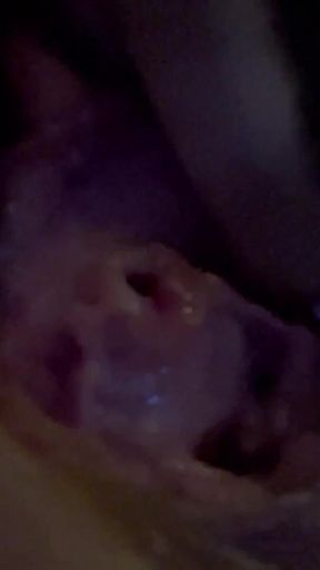 Sklavins Shows Her Destroyed Peehole After the First Pisshole Fuck by Her Master!