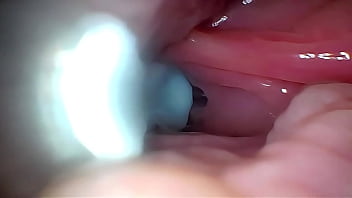 Semen in Cervix Wide Stretching Pussy Endoscope!