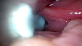 Semen in Cervix Wide Stretching Pussy Endoscope!
