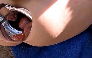 Extreme Anal Fisting for My Loose Sloppy Asshole