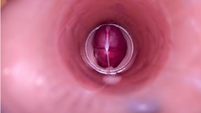 Female Insemination - Internal Camera Captures Deep Male Ejaculation
