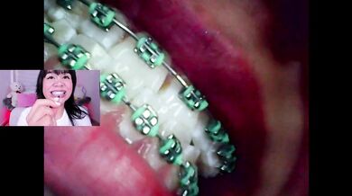 Lila jordan, Mini cam, vore fetish, endoscope