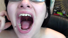 My Uvula