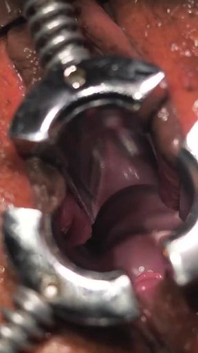 Fisting, medioeval Speculum and Orgasm for Lady Sonia milf.mp4   Clip 1