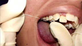 Using dental floss (close-up) Natural teeth