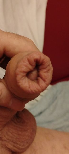 foreskin shower