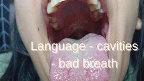 White tongue - bad breath and tartar