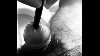 URETHRAL SOUND - Second time 7.5 mm