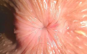 Extreme Close up: Teenage Butthole Is Trying to Kiss You Trough the Screen of Your Iphone