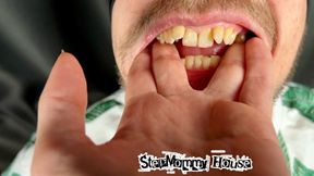 She Shoved her Whole Hand into her Mouth - Crooked Teeth, Vore, Pushing Fingers into Mouth, Sucking Hand