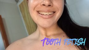 Oral hygiene