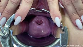 Glass Dildo Cervix Penetration