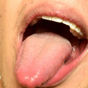 Drooling and showing uvula in HD drooling