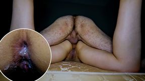 turkish couple MatureTube com 