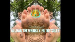 All hail the filthy, wrinkly soles
