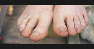 Dirty Feet and Long Toes - UnicornDisney