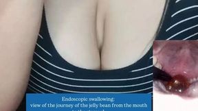 Endoscopic swallowing: view of the journey of the jelly bean from the mouth to the stomach