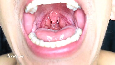 Exciting uvula