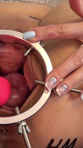 Crazy games with my cervix. The trailer   Clip 1