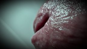 why is my pee hole always so damp?