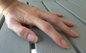 Only long natural fingernails
