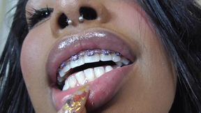 Black girl teeth brace fetish!