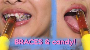 Show my braces, sucking on candy