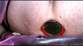 huge anal toys and prolapse