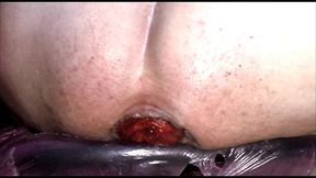 huge anal toys and prolapse