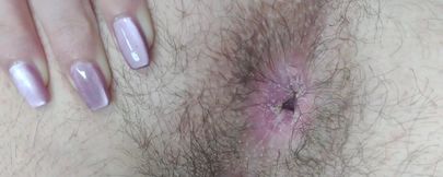 Asshole Hairy Extreme Closeup