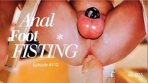 FeetingMe 110: Anal Hand & Foot Fisting + Chastity Cock Cage + Prostate Massage